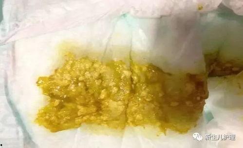婴儿吃牛角瓜拉肚子,警惕婴幼儿饮食安全